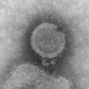 H7N9_CDC