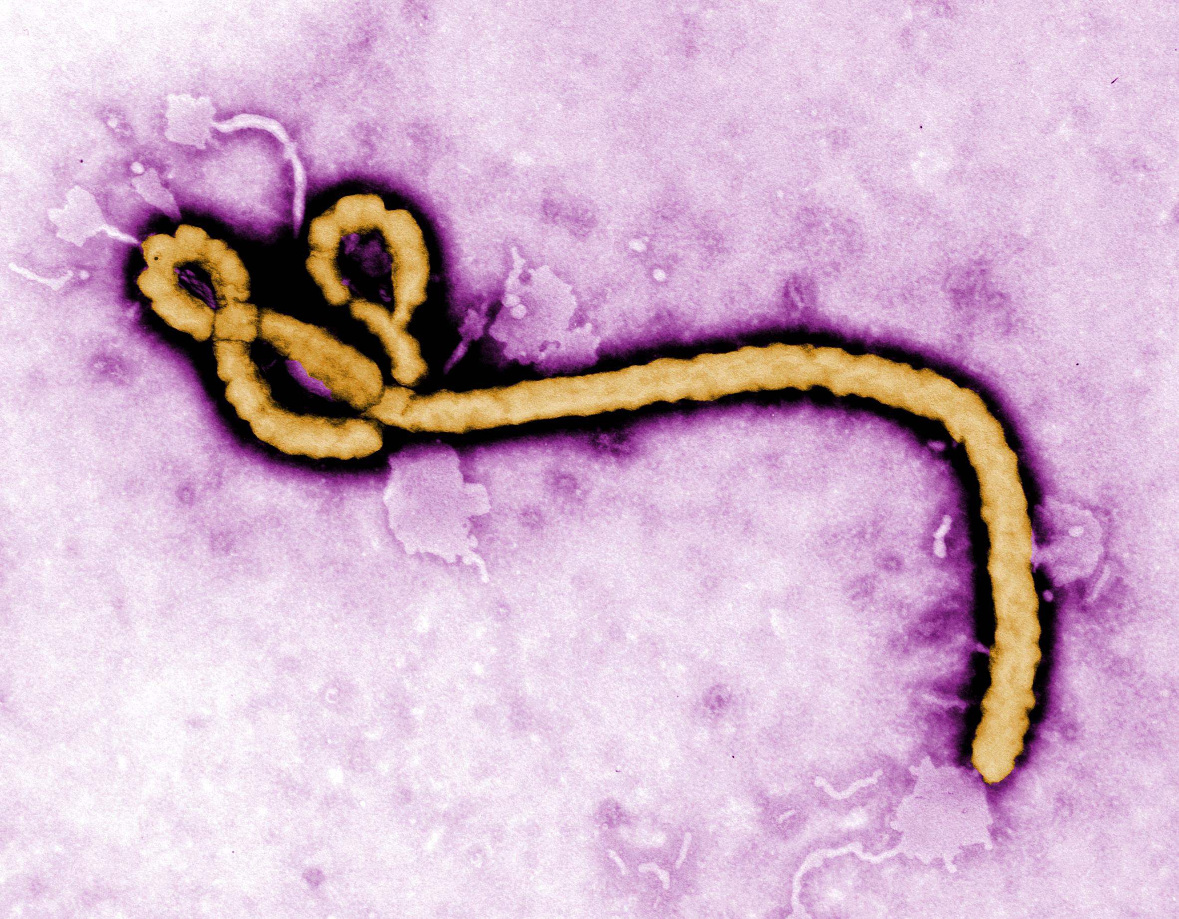 Ebola vírus)