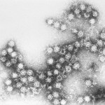 Comentarios virus-lentos (25): Enterovirus, salta la sorpresa.