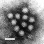 Comentaris virus-lents (24): Norovirus i Andorra; res a declarar?