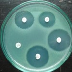 Nanopartículas de plata para mejorar el efecto antimicrobiano de los antibióticos