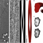 Se resuelve la estructura de un prión infeccioso