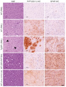 Estudi neuropatològic dels encèfals dels models de ratolí utilitzats.