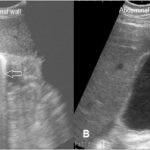 Bovine Fascioliasis: Neglected Infectious Tropical Disease with Recent Re-Emergence in The Nile Delta of Egypt