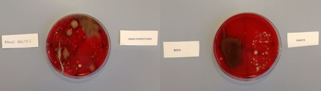 Exemple de resultat de les plaques. Esquerra: mans brutes/mans desinfectades. Dreta: boca/sabata.