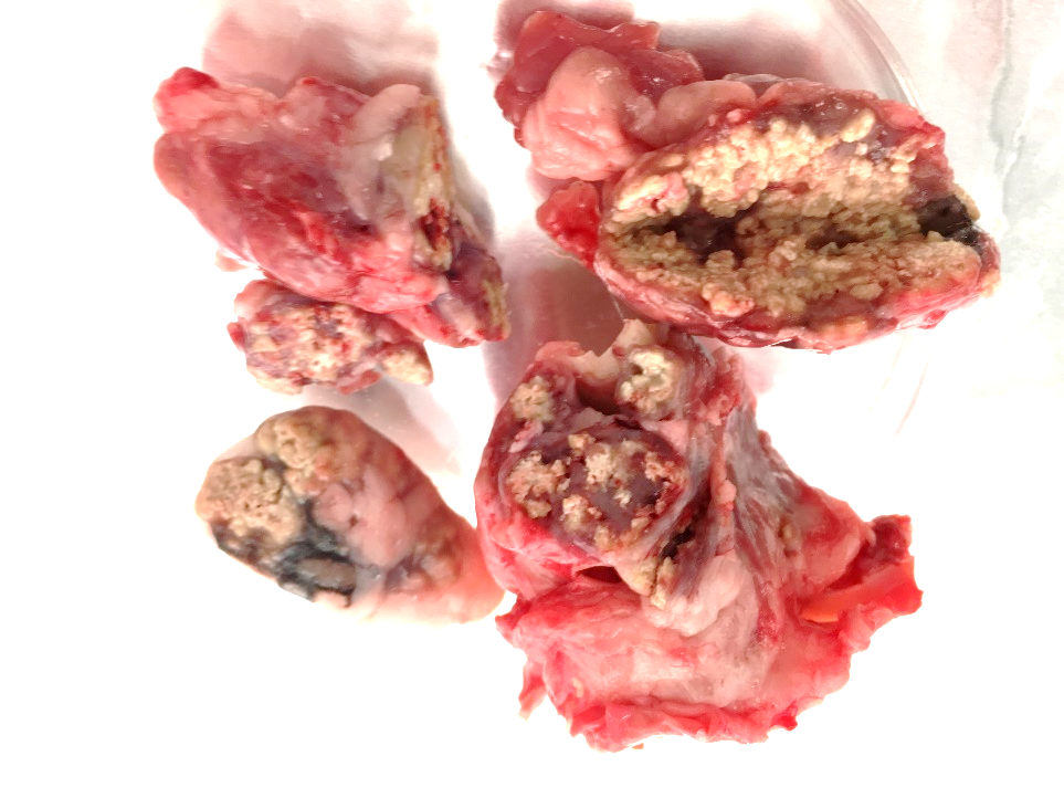 Lesions tuberculoses en nòduls limfàtics submandibulars de senglar.
