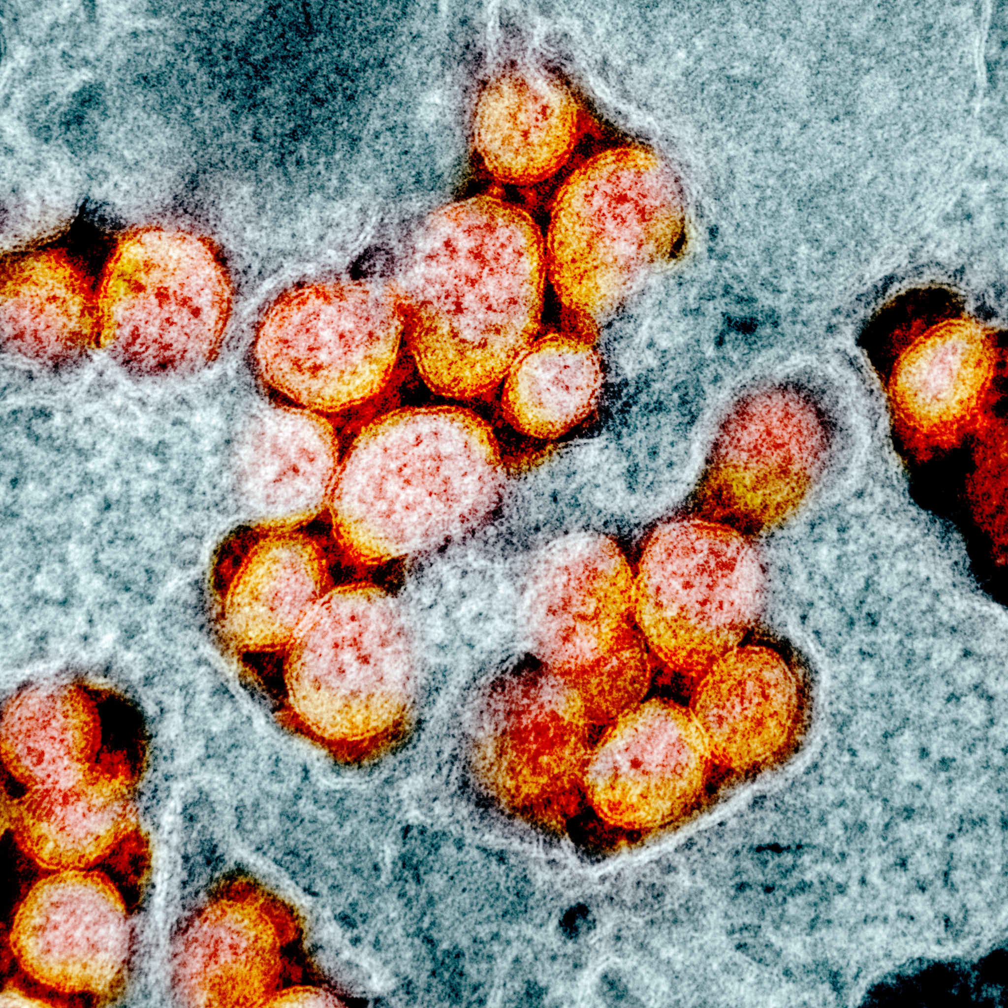 Virus SARS-CoV-2./NIAID (CC BY 2.0)
